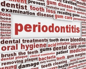 Periodontitis