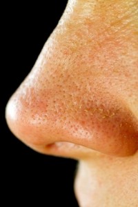Large Pores Large Pores