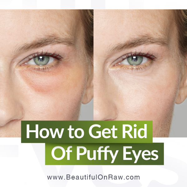 Suffering From Puffy Under Eyes ! How To Get Rid Of Puffy Eyes Instant –  Derma Essentia