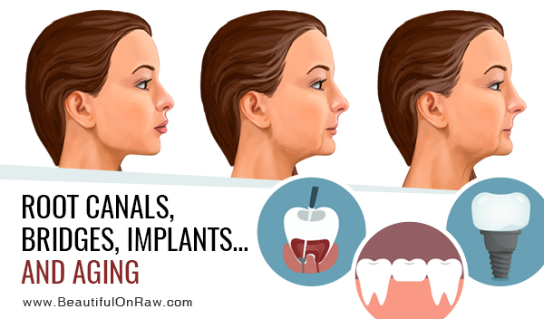 Root Canals, Bridges, Implants…and Aging