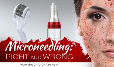 microneedling