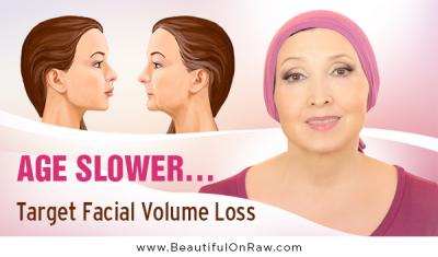 Facial volume loss